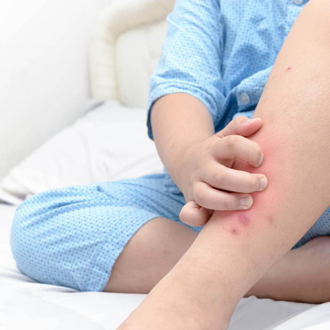 Few Tips for Repelling Mosquitoes from Baby’s Skin Make Me Feel